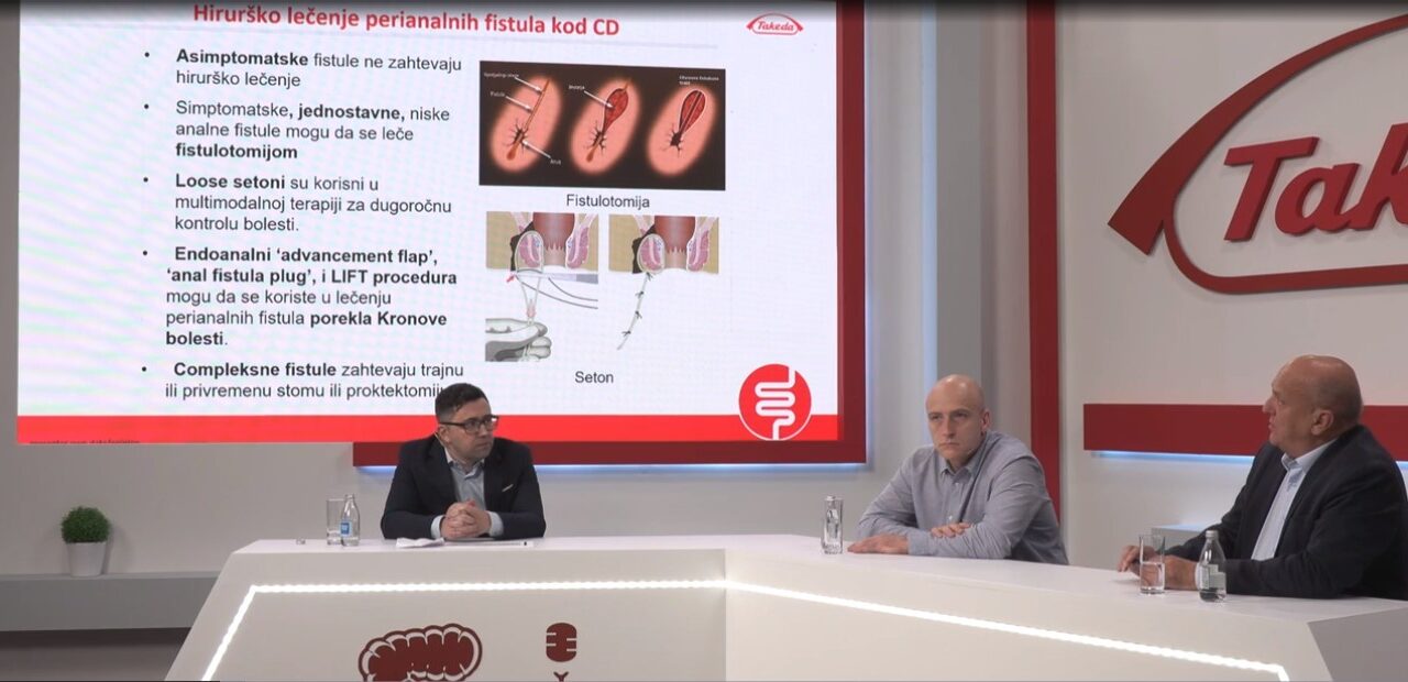 Savremena terapija perianalnih fistula