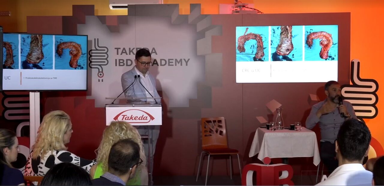 Prepoznavanje i rešavanje komplikacija u IBD