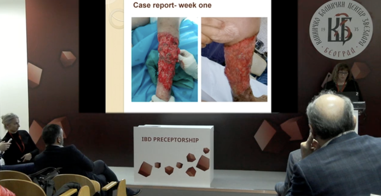 Treći „IBD Preceptorship“ – I deo
