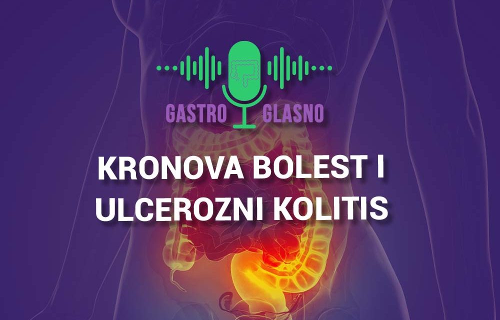 Deveta epizoda – Savremeni pristup Kronovoj bolesti i ulceroznom kolitisu